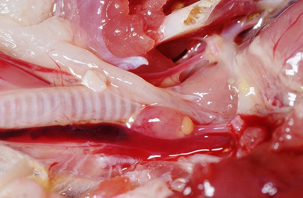 甲状腺